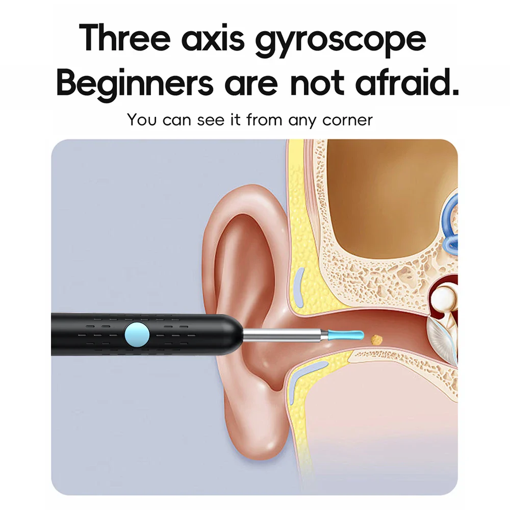 SmartScan Wireless Ear Cleaner with Camera